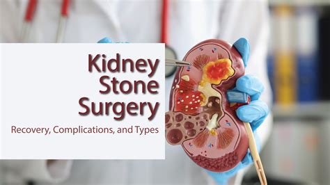 How Much is Kidney Stone Surgery: A Journey Through the Labyrinth of Medical Costs and Metaphors